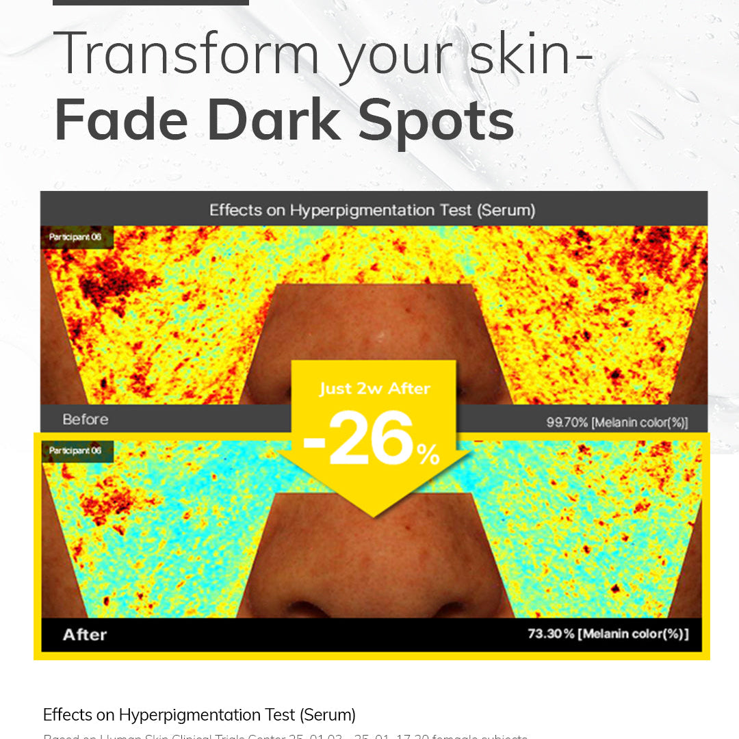 🌟Illuminate Your Skin: Unveiling the Wonders of Hype-Light Serum! 🌟