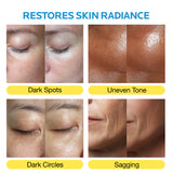[new!] Niacindy Dark Spot Amoule