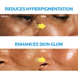 [new!] Niacindy Radiance Cream