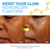 [new!] Niacindy Glow Reset Toner